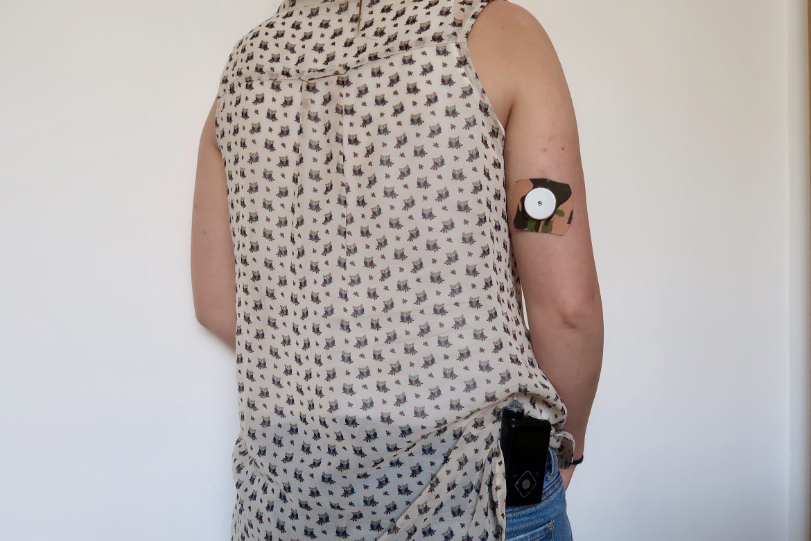 A woman stands facing a white wall. You can see her freestyle libre on her arm with a camouflage patch on it, and an insulin pump on her hip 