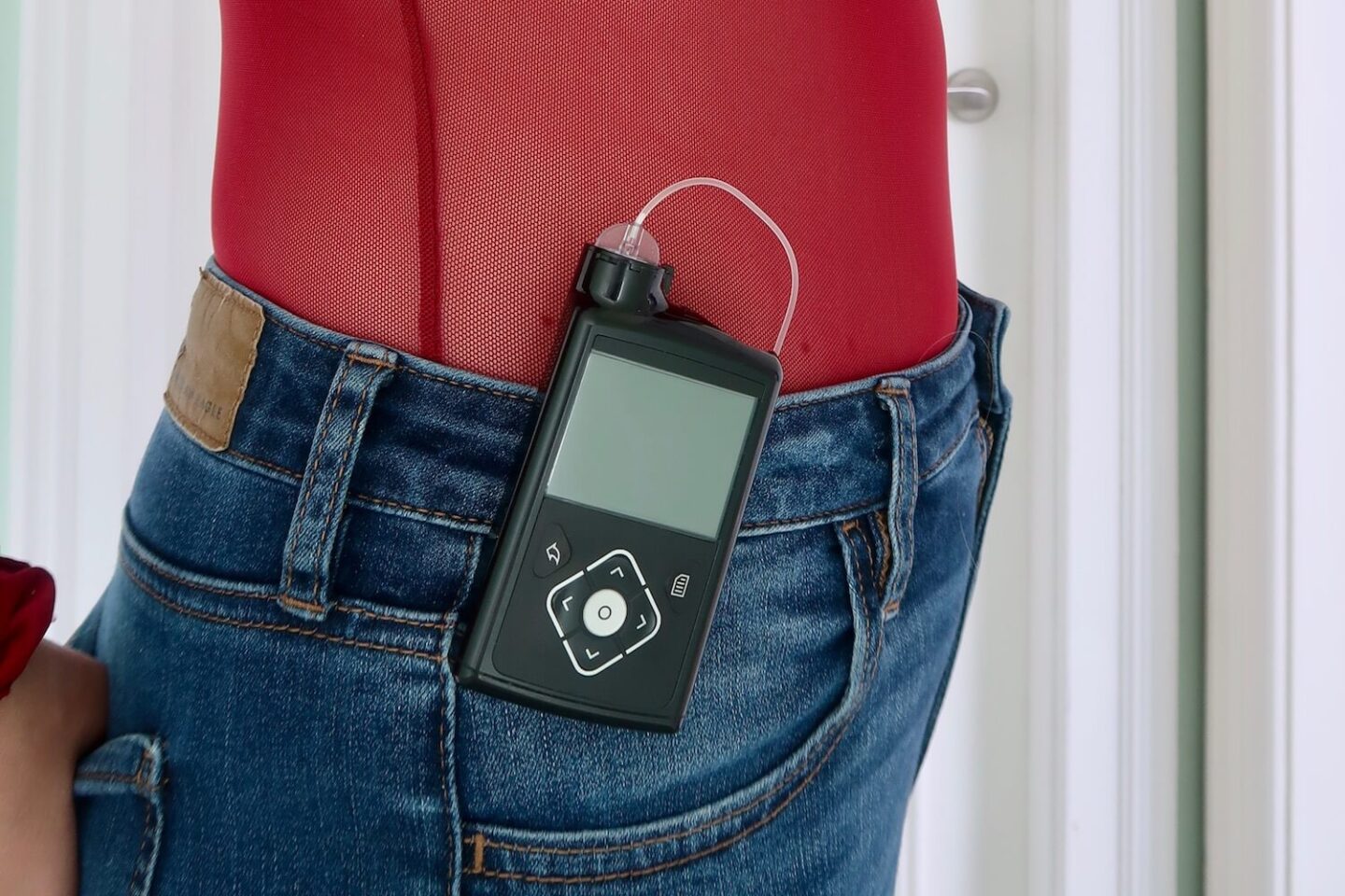 A medtronic insulin pump clipped to a pair of jeans