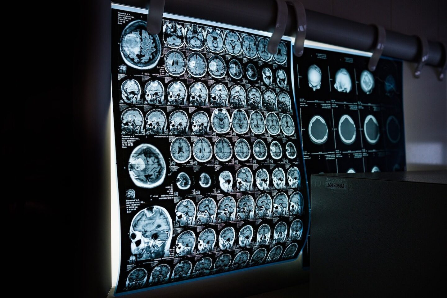 A set of CT scan or MRI scan images of a persons head
